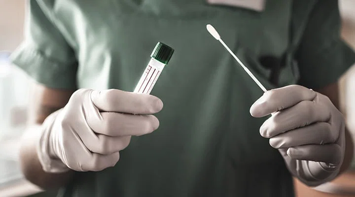 nurse holds a swab for the coronavirus / covid19 test